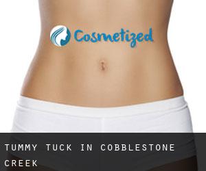 Tummy Tuck in Cobblestone Creek