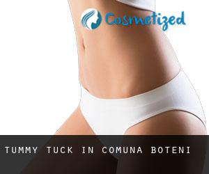 Tummy Tuck in Comuna Boteni