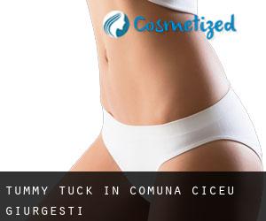 Tummy Tuck in Comuna Ciceu-Giurgeşti
