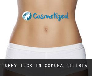 Tummy Tuck in Comuna Cilibia