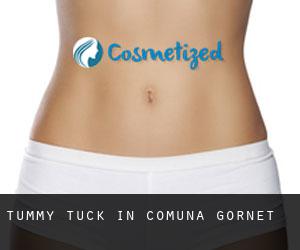 Tummy Tuck in Comuna Gornet