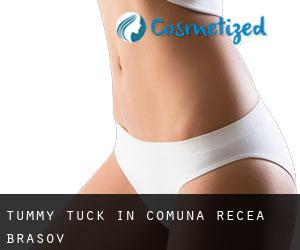 Tummy Tuck in Comuna Recea (Braşov)