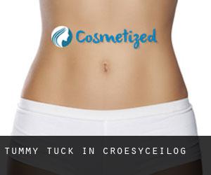 Tummy Tuck in Croesyceilog