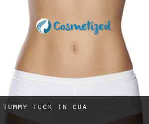 Tummy Tuck in Cúa