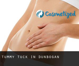Tummy Tuck in Dunbogan