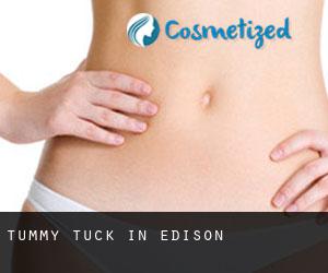 Tummy Tuck in Edison