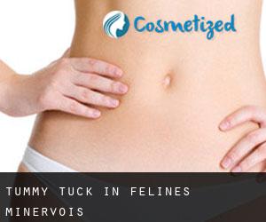 Tummy Tuck in Félines-Minervois