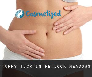 Tummy Tuck in Fetlock Meadows