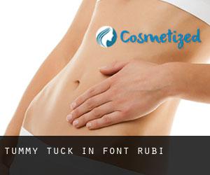 Tummy Tuck in Font-rubí