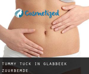 Tummy Tuck in Glabbeek-Zuurbemde