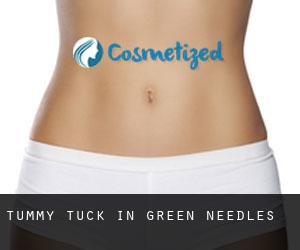 Tummy Tuck in Green Needles