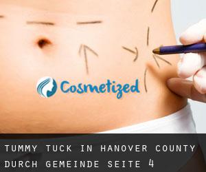 Tummy Tuck in Hanover County durch gemeinde - Seite 4