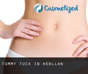 Tummy Tuck in Henllan