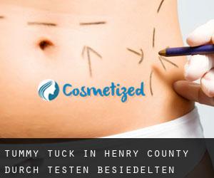 Tummy Tuck in Henry County durch testen besiedelten gebiet - Seite 2