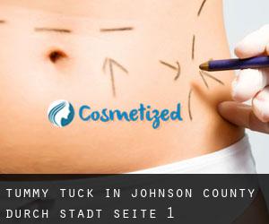 Tummy Tuck in Johnson County durch stadt - Seite 1