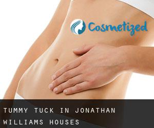 Tummy Tuck in Jonathan Williams Houses