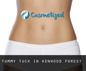 Tummy Tuck in Kenwood Forest