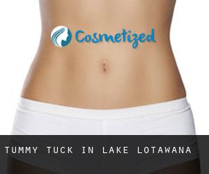Tummy Tuck in Lake Lotawana