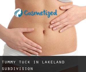 Tummy Tuck in Lakeland Subdivision