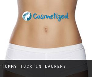 Tummy Tuck in Laurens