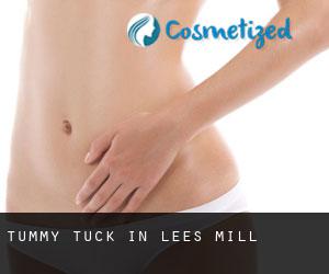 Tummy Tuck in Lees Mill