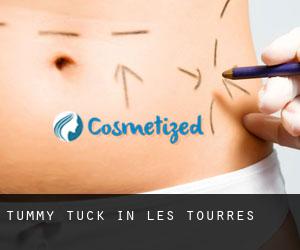 Tummy Tuck in Les Tourres