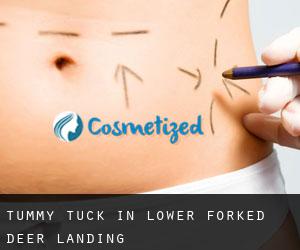 Tummy Tuck in Lower Forked Deer Landing