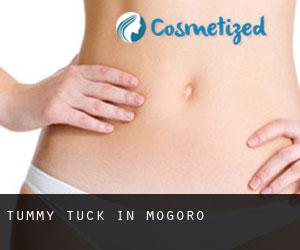 Tummy Tuck in Mogoro