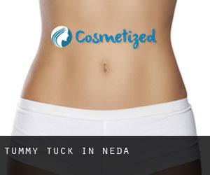 Tummy Tuck in Neda