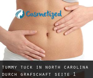 Tummy Tuck in North Carolina durch Grafschaft - Seite 1