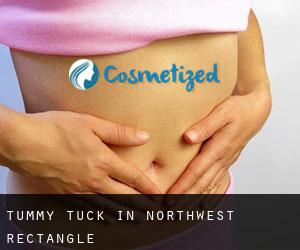 Tummy Tuck in Northwest Rectangle