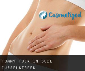 Tummy Tuck in Oude IJsselstreek