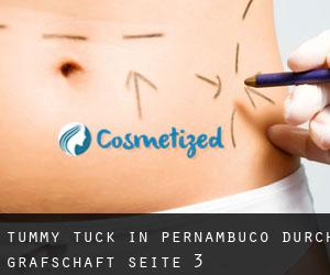 Tummy Tuck in Pernambuco durch Grafschaft - Seite 3