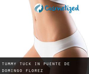 Tummy Tuck in Puente de Domingo Flórez