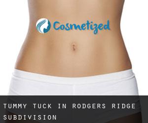 Tummy Tuck in Rodgers Ridge Subdivision