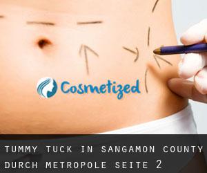 Tummy Tuck in Sangamon County durch metropole - Seite 2
