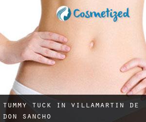 Tummy Tuck in Villamartín de Don Sancho