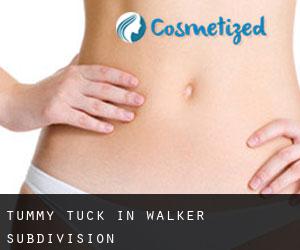 Tummy Tuck in Walker Subdivision