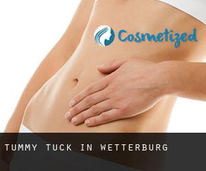 Tummy Tuck in Wetterburg