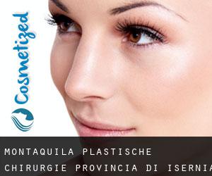 Montaquila plastische chirurgie (Provincia di Isernia, Molise)